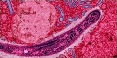 Le paludisme est une maladie causée par :