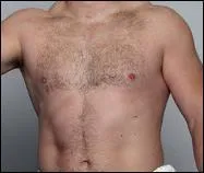 A qui appartient ce torse ?