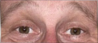 A quel acteur appartiennent ces yeux ?