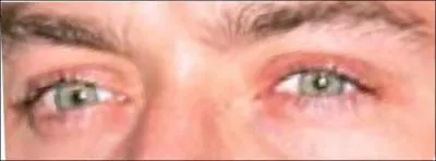 A qui appartiennent ces yeux ?