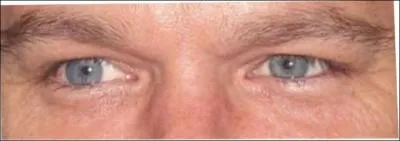 A qui appartiennent ces yeux ?