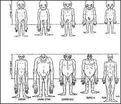 Qu'est-ce qu'une hyperthermie ?