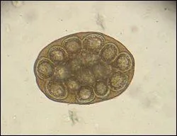 Parasites internes : quel ver, de la famille des cestodes (tnias) peut tre transmis par les puces ?