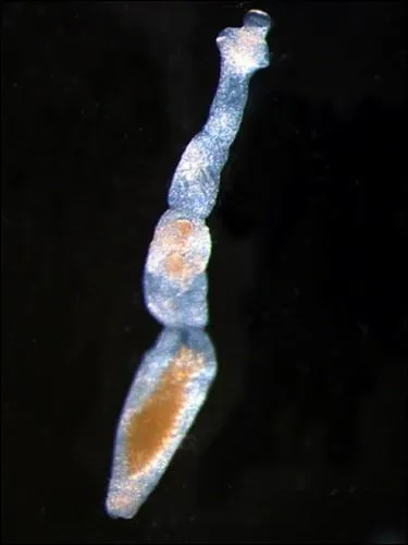 Parasites internes : comment s'appelle la maladie provoque par un ver (cestode), que l'homme peut attraper en avalant des baies infestes d'oeufs, couramment appele la maladie du renard ?