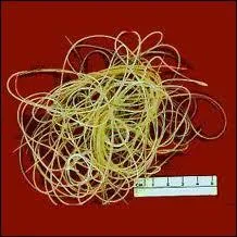 Parasites internes : quelle maladie parasitaire, due  un ver rond, prsente dans le sud de la France, est transmise au chien par un moustique et qu'on appelle 'ver du coeur' ?