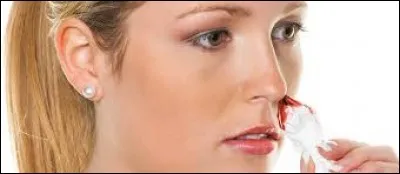 Comment appelle-t-on les saignements de nez ?