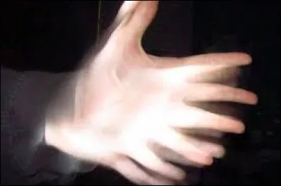 Maladie neurologique qui provoque des tremblements...