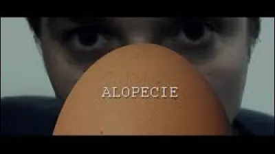 Si vous souffrez ''d'alopécie'' , vous avez des problèmes de...