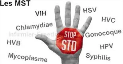 Quel terme ne désigne pas une maladie sexuellement transmissible (MST) ?