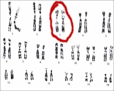 Film ralis en 1979 par David Cronenberg, c'est :