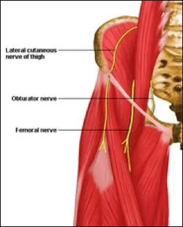 Dans l'abord ilioinguinal du cotyle selon Letournel, lors de la prparation de la fentre moyenne, un nerf est repr  son entre de l'obturator foramen. Un carteur agressif  ce niveau entra