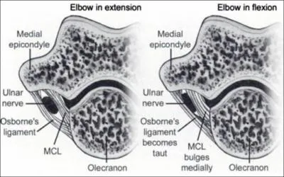 Le 'syndrome' dit du tunnel cubital rsulte de la compression du nerf cubital et de ses vaisseaux en arrire de l'pitrochle entre deux lments anatomiques. Lesquels ?