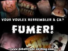 Le tabagisme est responsable de