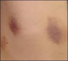 Quelle est la bonne orthographe de ce nom commun ?