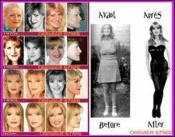 Combien d'interventions de chirurgie esthtique, l'amricaine Cindy Jackson a-t-elle subi ?