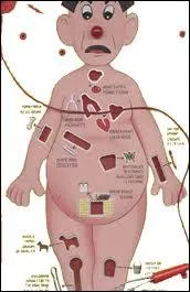 Quel jeu s'appelait 'Opration'  sa cration en 1965 ?