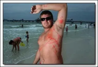 Cet homme, sorti de l'eau, vient de faire une mauvaise rencontre !