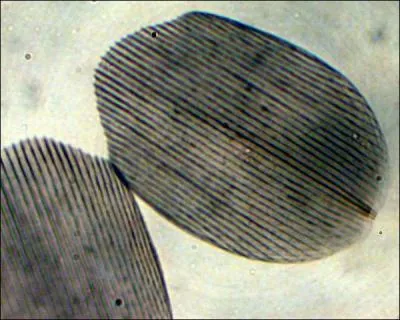 Cette photo prise au microscope reprsente des cailles... ?