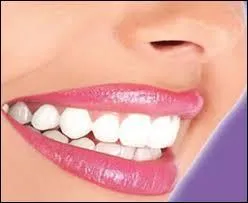 Bon, je ne vais pas le répéter : on cherche l'intrus. Les dents...