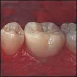 Je suis une molaire suprieure. Gnralement, combien ai-je de racines ?