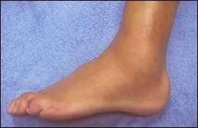 Cheville : le mot se traduit par :