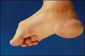 Talon : le mot se traduit par :