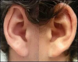 Oreilles : le mot se traduit par :