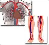 Mdecin spcialiste des veines et des artres, je suis un