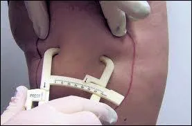 L'excs de ... dans le corps est stock dans le tissu adipeux.