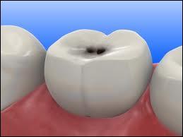 Sur cette image on peut apercevoir une dent ; mais qu'a-t-elle, cette dent ?