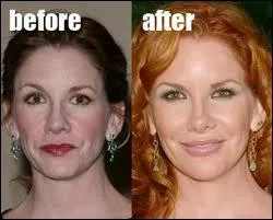 Cette actrice fut adore trs jeune grce  son rle de Laura, dans La petite maison dans la prairie. Qui est-ce ?