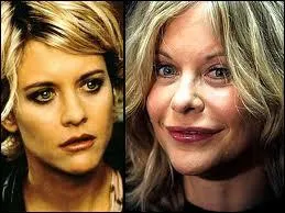 Elle tait toute mignonne Meg Ryan, dans Harry et Sally par exemple, avant qu'elle ne ravage son visage. Qui tait son mari du temps o elle n'avait pas touch au bistouri ?