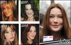 Des retouches, des retouches. . Et on ne parvient pas  dnicher des photos plus anciennes. C'est Carla Bruni qui est la demi-soeur de ?