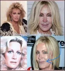 Vous souvenez-vous de cette actrice blonde de srie, Joan Van Ark. Elle est passionne de chirurgie malheureusement, mais c'est aussi une athlte spcialise dans quel sport ?