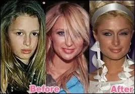 Voici l'volution qu'a voulue la riche hritire, jet setteuse et mdiatise. On voit qu'elle n'est pas blonde platine, que son nez n'est pas d'origine, qu'elle n'a pas les yeux bleus non plus. C'est ?