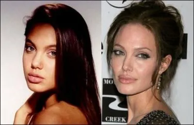 Eh oui, mme la beaut clbre n'est pas forcment tout  fait d'origine. Qui est cette star internationale, qui a manifestement dj touch  son nez ?