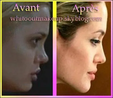 Et il n'y a pas que le nez, car pour quilibrer le profil, on a touch aussi ?