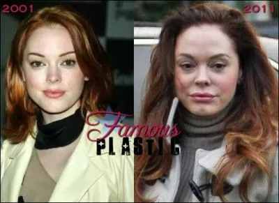 C'est l'une des soeurs de la srie Charmed, Paige. Cette jeune actrice a galement abus de la chirurgie. Qui est-elle ?