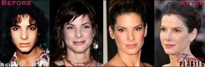 C'est une actrice oscarise que celle-ci qui elle aussi prserve sa jeunesse en ayant recours  la mdecine esthtique, mais a surtout touch  son nez (cliquez, c'est saisissant). Qui est-elle ?