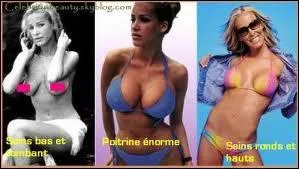 Voici Ophlie Winter, qui apprcie galement l'aide de la chirurgie esthtique, car elle a manifestement les mmes problmes que les autres... Qui a t son compagnon