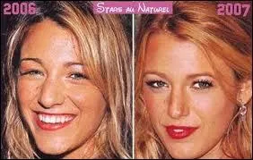 Blake Lively, ici en photo, a t choisie comme nouvelle grie de Chanel. Elle aussi a modifi son nez. A quelle srie TV doit-elle son succs ?