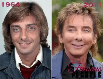 Voici un cas typique de trop de chirurgie. C'est le chanteur amricain Barry Manilow. L'un de ses tubes mondiaux tait ?