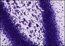 Qu'est-ce que la coloration de Nissl ?