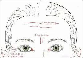 Les rides sont plus profondes et plus nombreuses aux environs des muscles ...