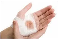 Une maladie hrditaire essentiellement masculine se manifeste par l'absence de coagulation lors d'une hmorragie. Quel est son nom ?