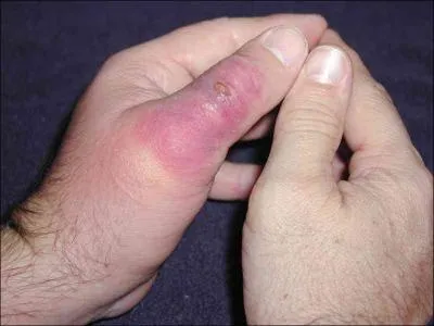 Que dit-on d'une personne qui perd la raison ?