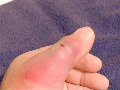 Vous connaissez bien sr le proverbe : Araigne du soir !