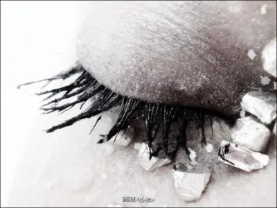 Cet oeil est celui :