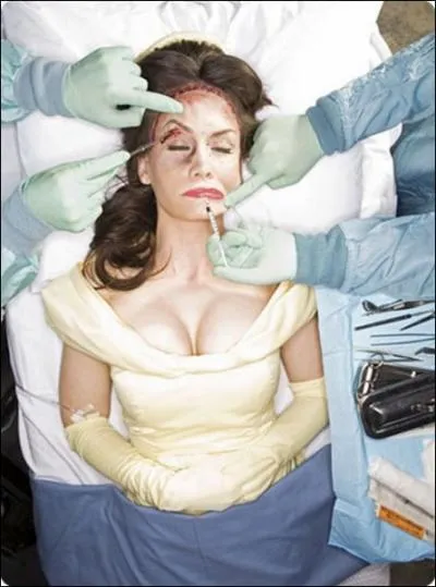 La Bte voulant que sa fiance garde une beaut ternelle, ce fut sances de chirurgie esthtique pour...