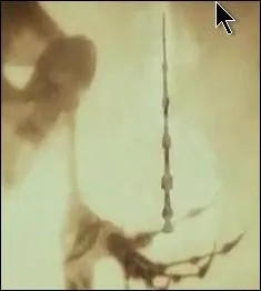 Que lui donna alors la Mort ?